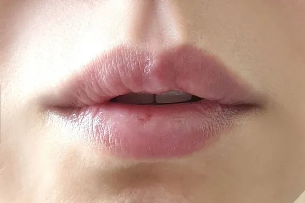 Labno 4SP Safe Lip Balm