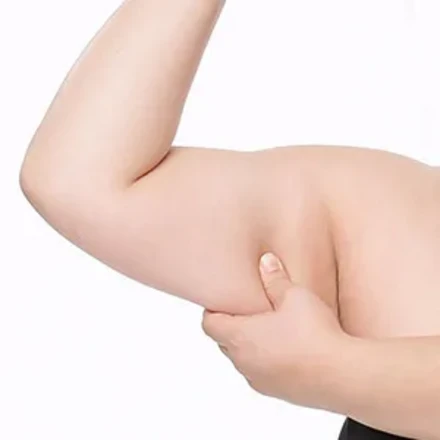 Lipo suction(abdomen)