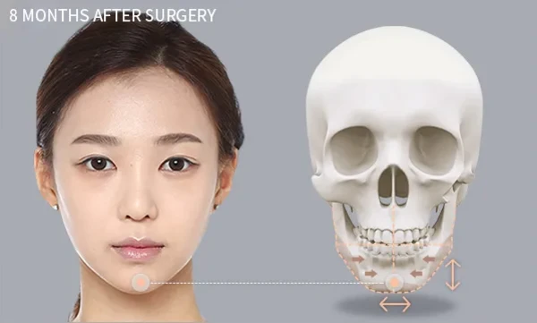 3 pcs Facial contouring