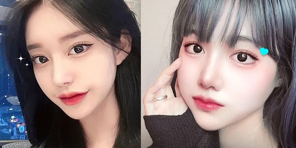 Upper blepharoplasty